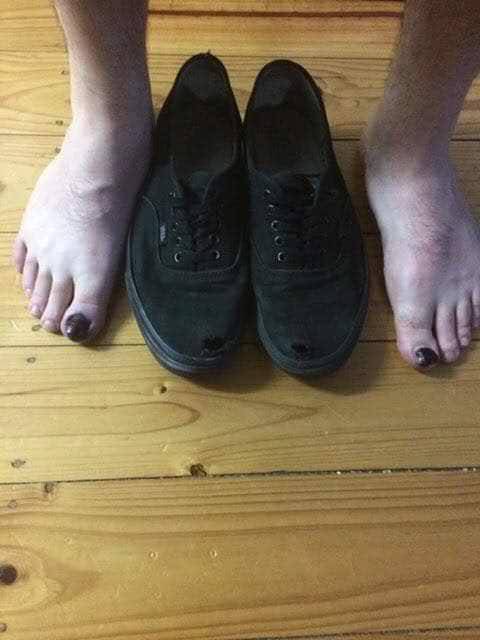 신발 구멍 났을 때.jpg