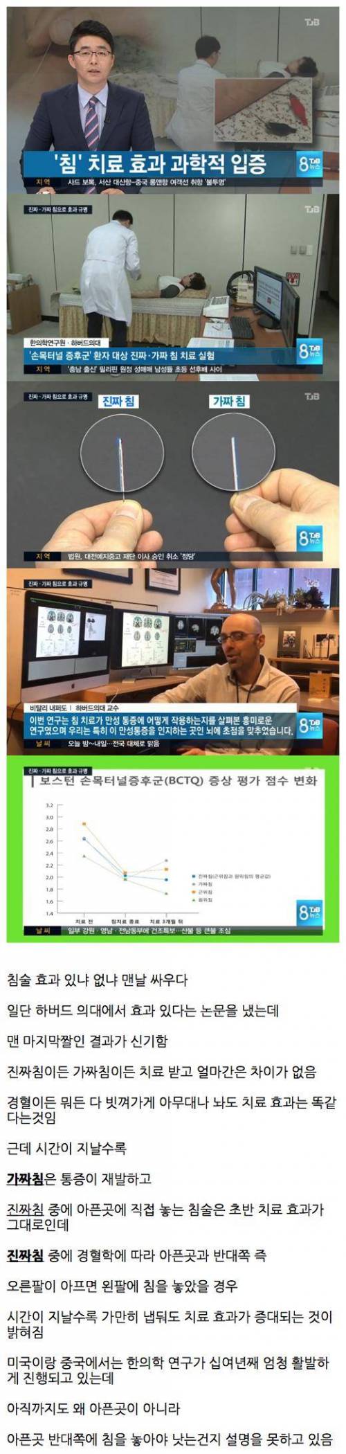침술의 흥미로운 실험.jpg