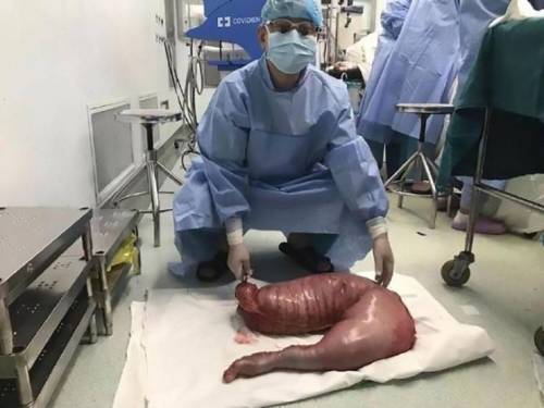 [혐주의]대륙의 22년동안 변비