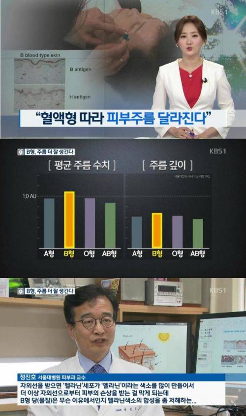 혈액형에 따른 주름 차이.jpg