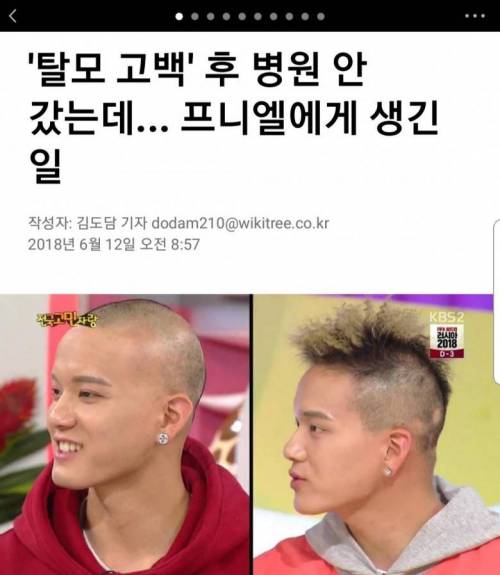 탈모 고백 한 어느 아이돌 근황.jpg