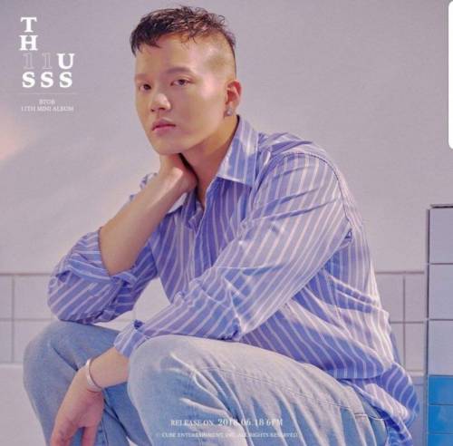 탈모 고백 한 어느 아이돌 근황.jpg