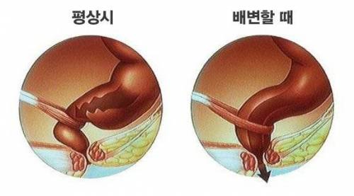 우리 몸에서 가장 중요한 근육 중 하나.jpg