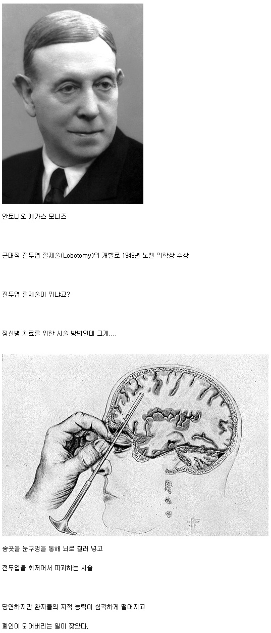 역대 최악의 노벨 의학상.jpg