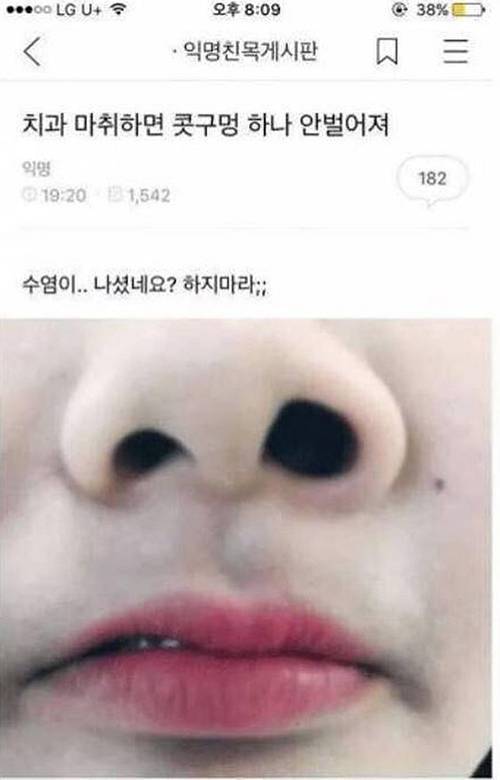 치과마취 후기.jpg