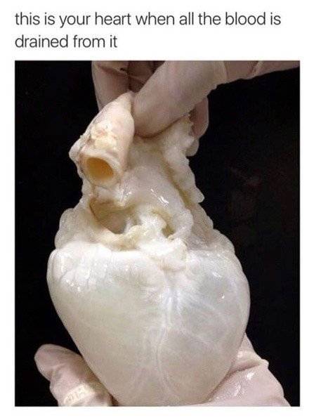 혈액을 모두 빼낸 심장.jpg
