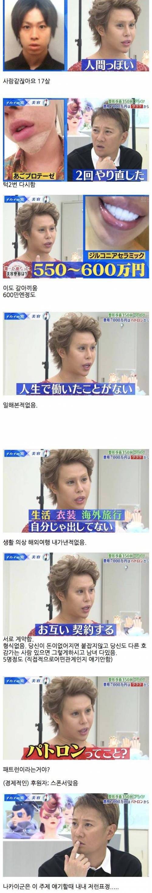미용 성형에 7000만엔 든 일본 남성.jpg