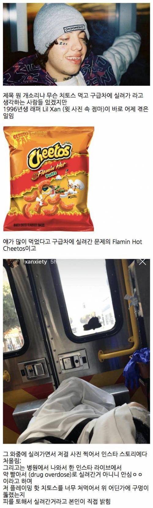 매운 치토스를  많이 먹어 구급차 탄 래퍼.jpg
