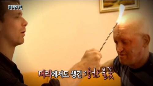 [스압] 온 몸에 전기가 흐르는 남자.jpg