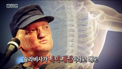 [스압] 온 몸에 전기가 흐르는 남자.jpg