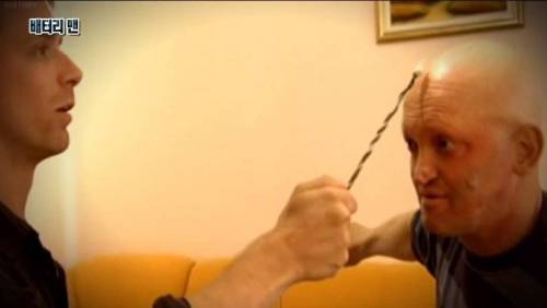 [스압] 온 몸에 전기가 흐르는 남자.jpg