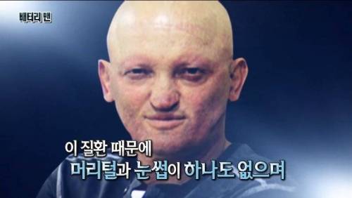 [스압] 온 몸에 전기가 흐르는 남자.jpg