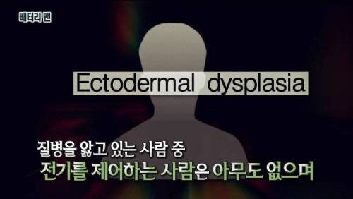 [스압] 온 몸에 전기가 흐르는 남자.jpg