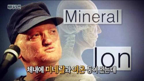 [스압] 온 몸에 전기가 흐르는 남자.jpg