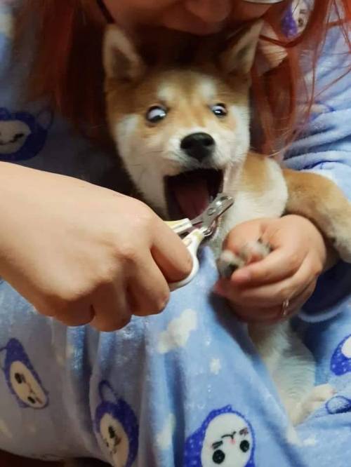 손톱을 자르는데 물어서 저도 물기로 했습니다.