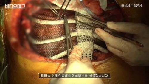 [스압] 신에 도전하는 인간 디지털 헬스케어.jpg