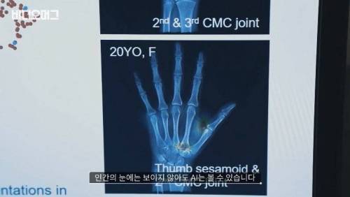 [스압] 신에 도전하는 인간 디지털 헬스케어.jpg