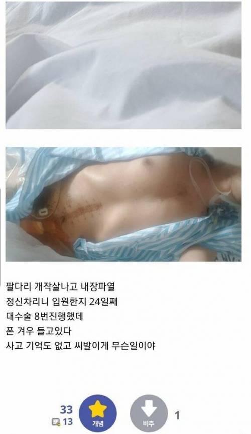 사고로 병원에서 눈 떠보니 24일 지남.jpg