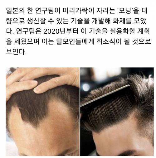 탈모인들 진짜 희소식.jpg
