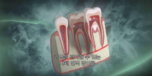 [스압] 신경치료의 진실(?).jpg