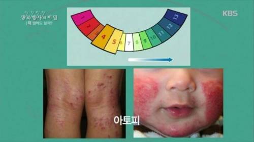 [스압] 때밀기가 피부에 미치는 영향.jpg