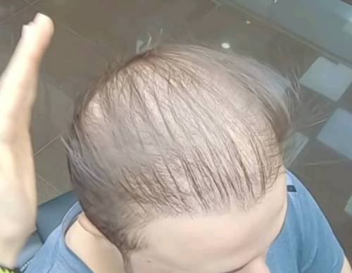 신기한 대머리 스프레이.jpg