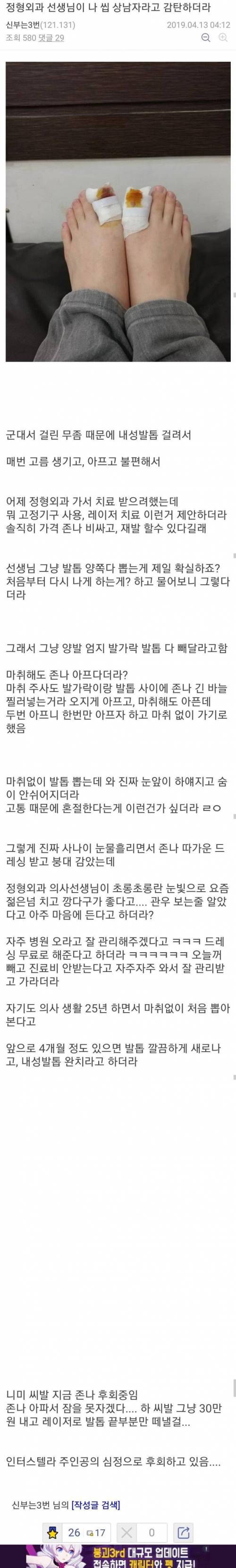 발톱뽑기.jpg