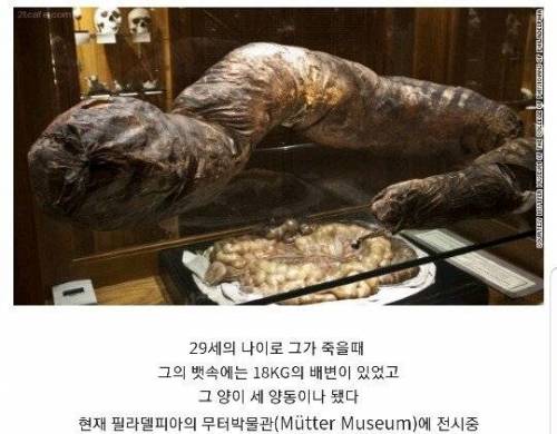 [약더]13년간 똥을 싸지 못한 남자.jpg