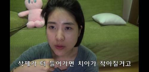 [스압] 라미네이트 하지마세요 .jpg