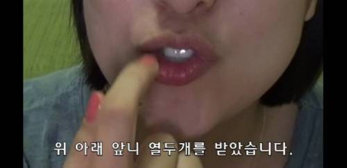[스압] 라미네이트 하지마세요 .jpg