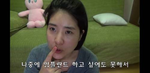 [스압] 라미네이트 하지마세요 .jpg