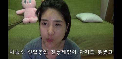 [스압] 라미네이트 하지마세요 .jpg