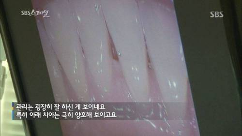 [스압] 입냄새 제거하는 법.jpg