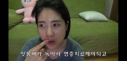 [스압] 라미네이트 하지마세요 .jpg