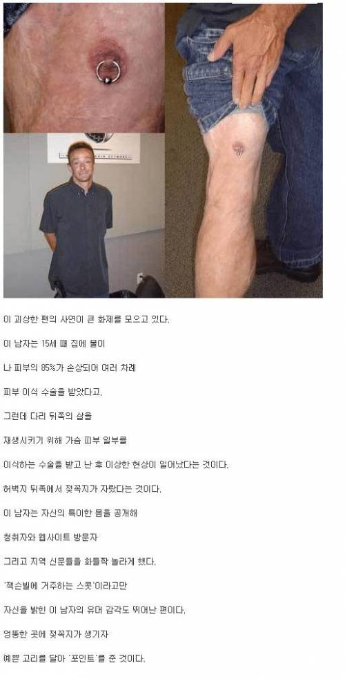 다리에 꼭지가 난 남자