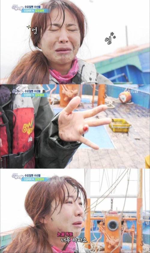 갑오징어한테 물린 리포터.jpg