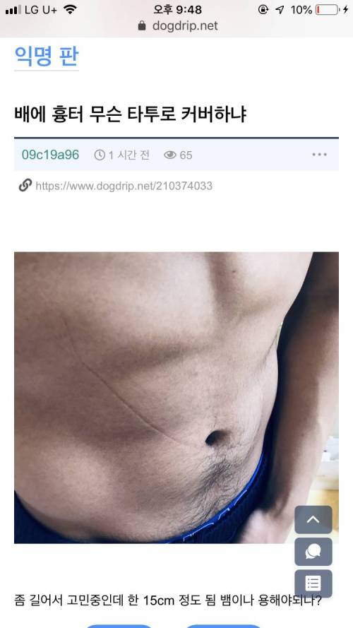 [더럽주의] 배에 흉터 뭘로 커버하냐??