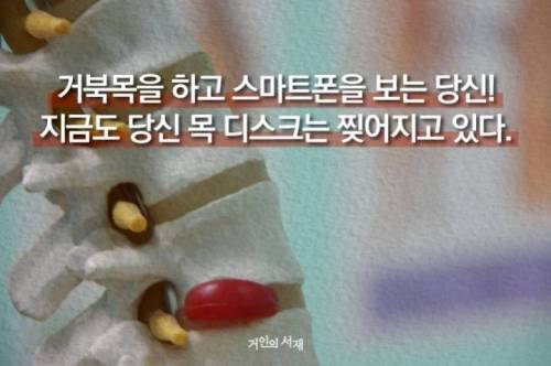 [스압] 거북목 회복 5계명....jpg