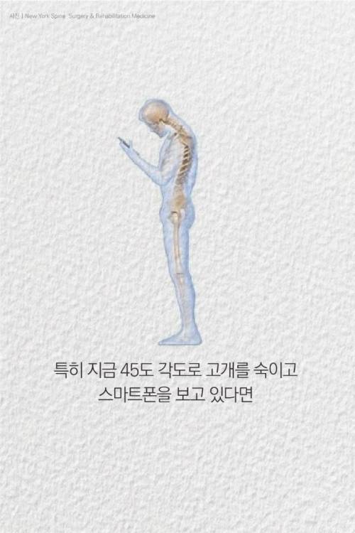 [스압] 거북목 회복 5계명....jpg