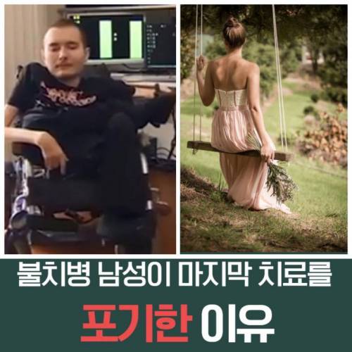 [스압] 살기 위해 머리 이식 수술을 선택했던 사람.jpg