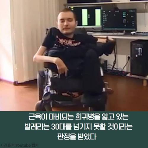 [스압] 살기 위해 머리 이식 수술을 선택했던 사람.jpg