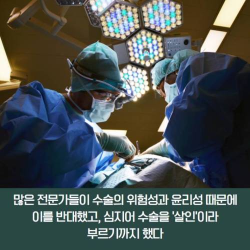 [스압] 살기 위해 머리 이식 수술을 선택했던 사람.jpg