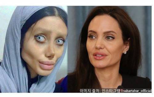 안젤리나 졸리 따라 50번 성형한 이란 여자.jpg