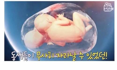 [스압] 두 달 차이로 세상에 나온 세쌍둥이.jpg