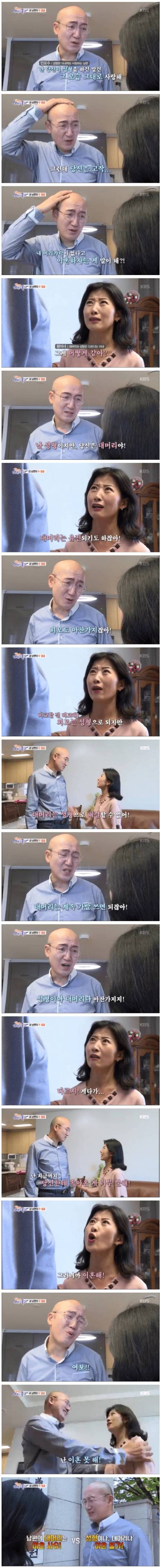 대머리vs성형.jpg