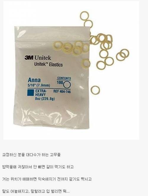 치아교정 짜증나는 아이템 중 하나.jpg