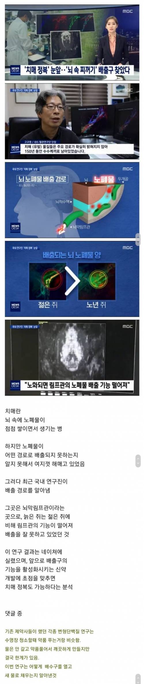 치매 정복이 눈앞, 뇌 속 찌꺼기 배출구 찾아.jpg