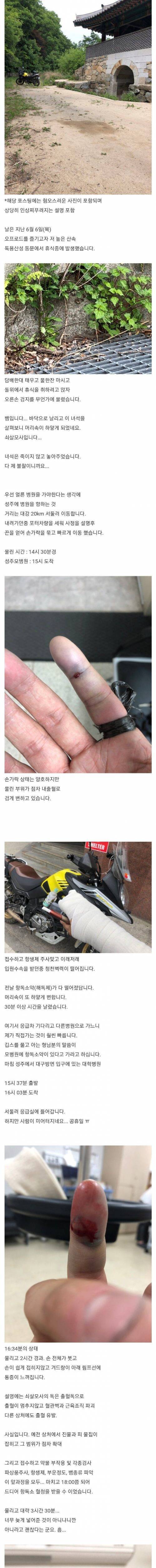 [스압] [극혐] 쇠살모사 한테 손가락 물린 후기.jpg