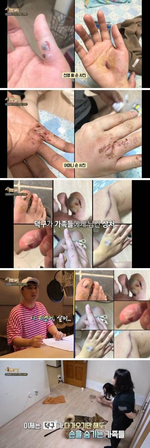 [스압] 촬영 중 개한테 물린 피디.jpg