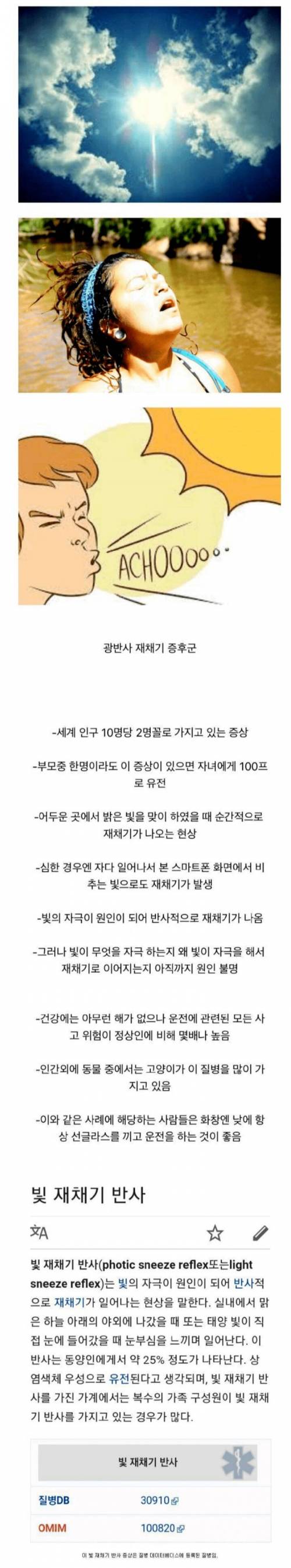 동양인 25%가 갖고있는 증상.jpg